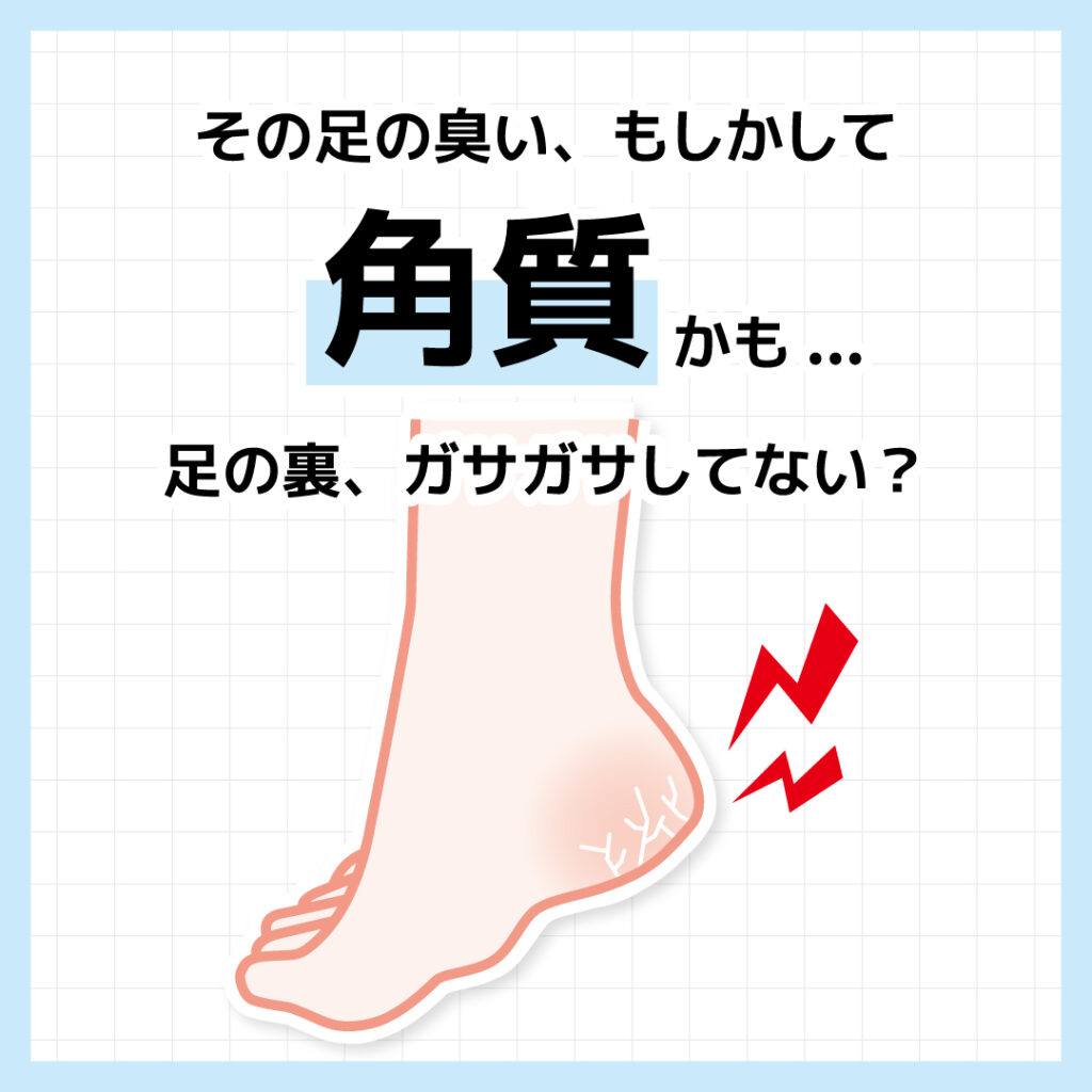 角質かも...足の裏、ガサガサしてない？その足の臭い、もしかして　