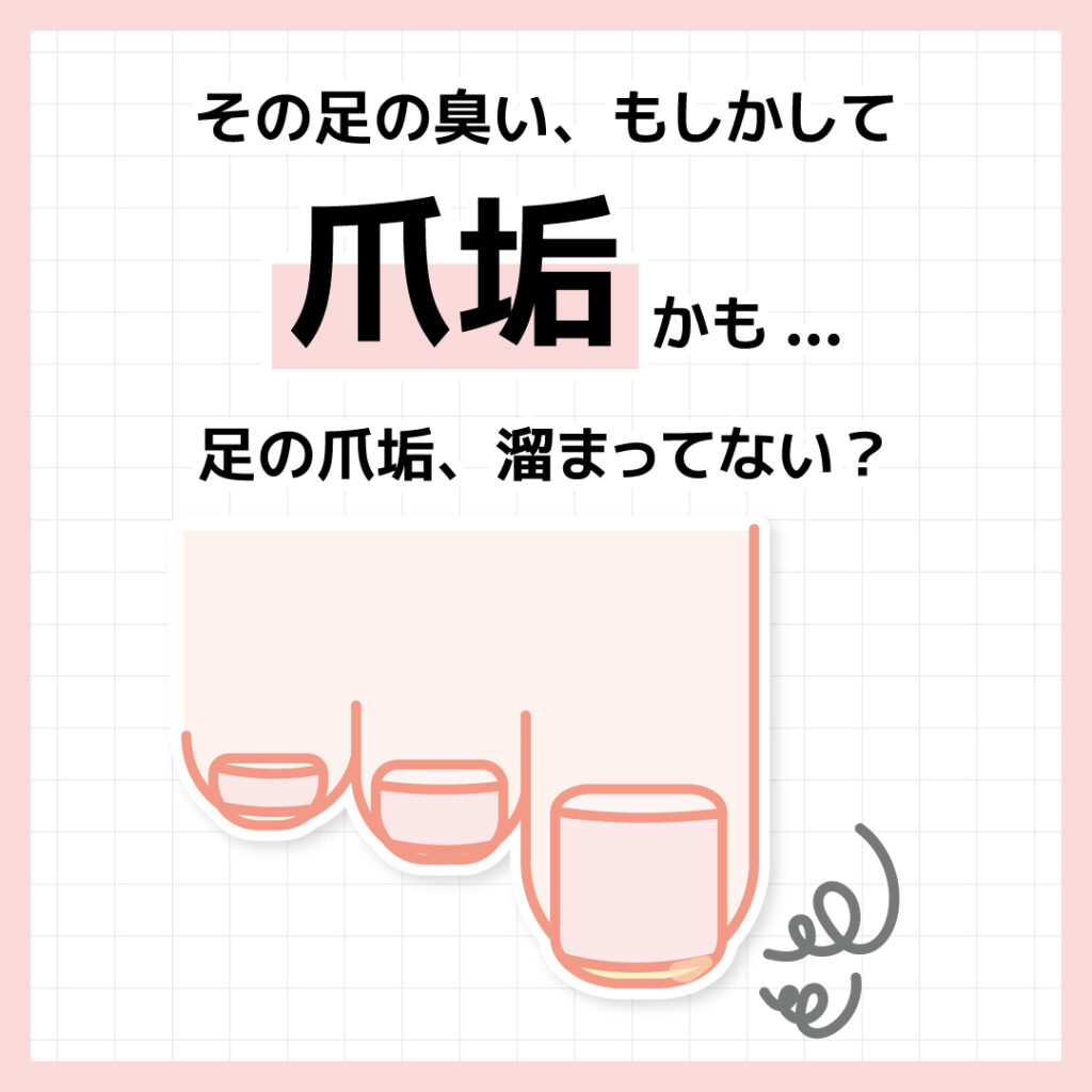 かも...爪垢足の爪垢、溜まってない？その足の臭い、もしかして