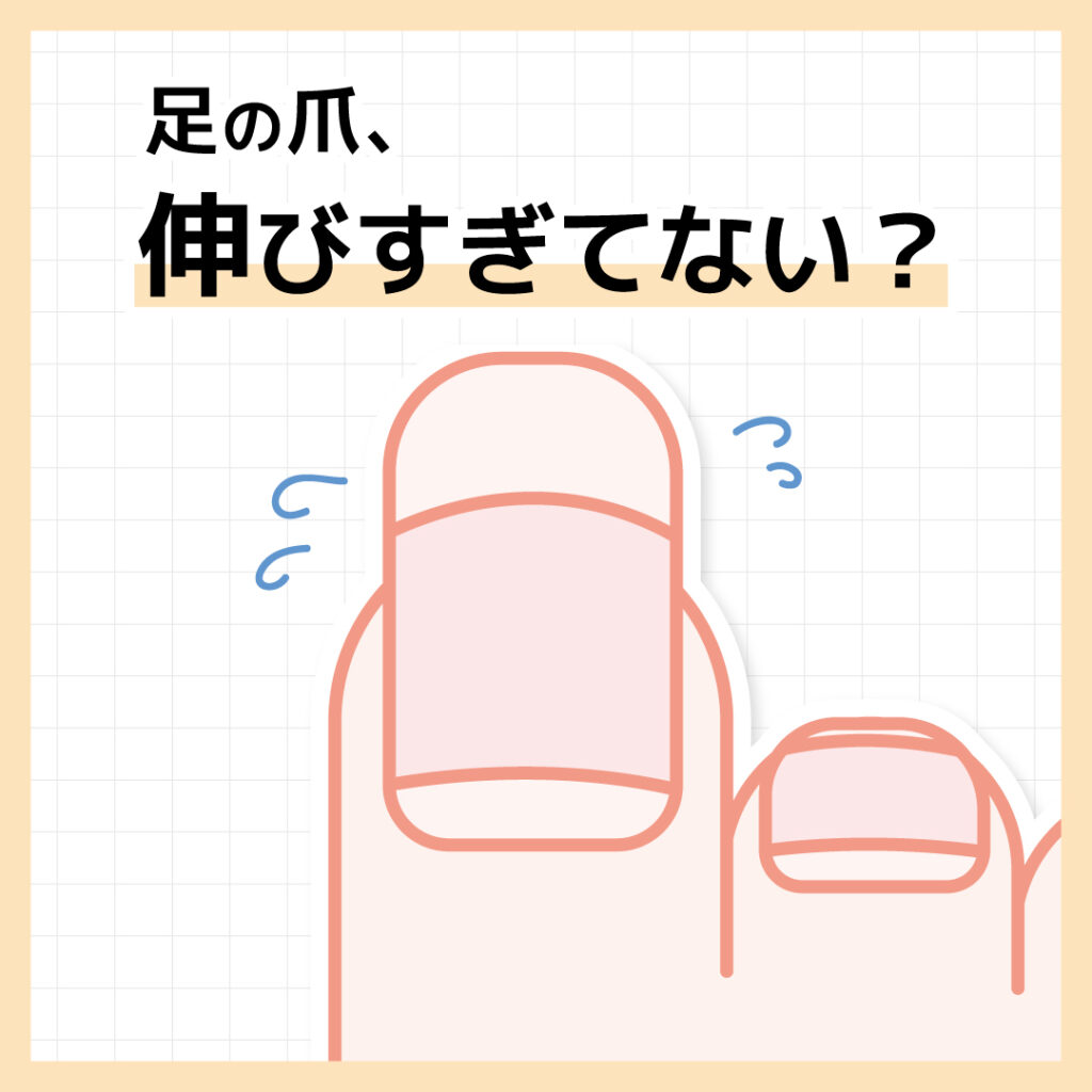 ２週間に１回など、
定期的なケアで
足の臭いを改善！手の爪は1日に約0.1mm伸びると
言われており、足の爪は1日に
手の爪の半分伸びると言われています。爪が伸びると、その分爪垢が溜まりやすくなり
臭いの原因になります。夏は冬の乾燥している時期とは逆で、
水分の潤いで爪が伸びるのが早くなります。